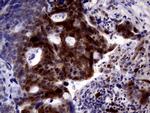 TYMS Antibody in Immunohistochemistry (Paraffin) (IHC (P))