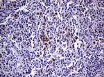 TYMS Antibody in Immunohistochemistry (Paraffin) (IHC (P))