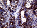 TYMS Antibody in Immunohistochemistry (Paraffin) (IHC (P))