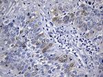 TYMS Antibody in Immunohistochemistry (Paraffin) (IHC (P))