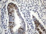 TYMS Antibody in Immunohistochemistry (Paraffin) (IHC (P))