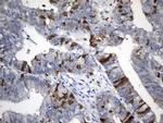 TYMS Antibody in Immunohistochemistry (Paraffin) (IHC (P))