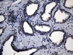 TYMS Antibody in Immunohistochemistry (Paraffin) (IHC (P))