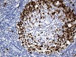 TYMS Antibody in Immunohistochemistry (Paraffin) (IHC (P))