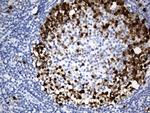 TYMS Antibody in Immunohistochemistry (Paraffin) (IHC (P))