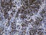 TYMS Antibody in Immunohistochemistry (Paraffin) (IHC (P))