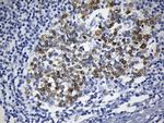 TYMS Antibody in Immunohistochemistry (Paraffin) (IHC (P))