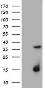 TYMS Antibody in Western Blot (WB)