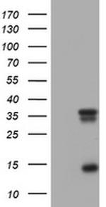 TYMS Antibody in Western Blot (WB)