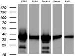 TYMS Antibody in Western Blot (WB)