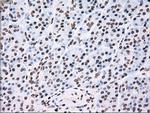 TYRO3 Antibody in Immunohistochemistry (Paraffin) (IHC (P))