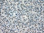 TYRO3 Antibody in Immunohistochemistry (Paraffin) (IHC (P))