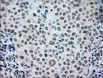 TYRO3 Antibody in Immunohistochemistry (Paraffin) (IHC (P))