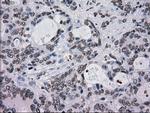 TYRO3 Antibody in Immunohistochemistry (Paraffin) (IHC (P))