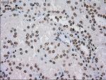 TYRO3 Antibody in Immunohistochemistry (Paraffin) (IHC (P))