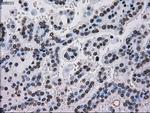 TYRO3 Antibody in Immunohistochemistry (Paraffin) (IHC (P))