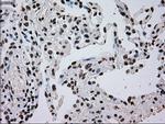 TYRO3 Antibody in Immunohistochemistry (Paraffin) (IHC (P))