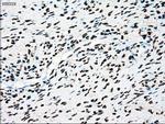 TYRO3 Antibody in Immunohistochemistry (Paraffin) (IHC (P))