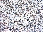 TYRO3 Antibody in Immunohistochemistry (Paraffin) (IHC (P))