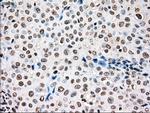 TYRO3 Antibody in Immunohistochemistry (Paraffin) (IHC (P))