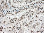 TYRO3 Antibody in Immunohistochemistry (Paraffin) (IHC (P))