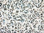 TYRO3 Antibody in Immunohistochemistry (Paraffin) (IHC (P))