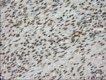 TYRO3 Antibody in Immunohistochemistry (Paraffin) (IHC (P))