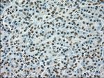 TYRO3 Antibody in Immunohistochemistry (Paraffin) (IHC (P))