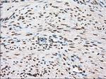 TYRO3 Antibody in Immunohistochemistry (Paraffin) (IHC (P))