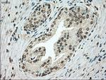 TYRO3 Antibody in Immunohistochemistry (Paraffin) (IHC (P))