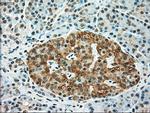 TYRO3 Antibody in Immunohistochemistry (Paraffin) (IHC (P))