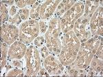 TYRO3 Antibody in Immunohistochemistry (Paraffin) (IHC (P))