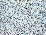 TYRO3 Antibody in Immunohistochemistry (Paraffin) (IHC (P))