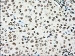 TYRO3 Antibody in Immunohistochemistry (Paraffin) (IHC (P))