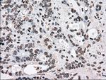 TYRO3 Antibody in Immunohistochemistry (Paraffin) (IHC (P))