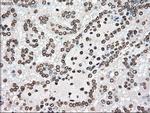 TYRO3 Antibody in Immunohistochemistry (Paraffin) (IHC (P))