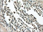 TYRO3 Antibody in Immunohistochemistry (Paraffin) (IHC (P))