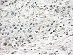 TYRO3 Antibody in Immunohistochemistry (Paraffin) (IHC (P))