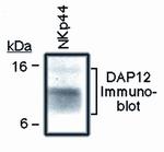 TYROBP Antibody in Western Blot (WB)