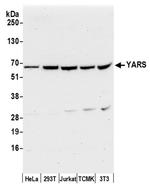 YARS/Tyrosyl-tRNA Synthetase/TYRRS Antibody in Western Blot (WB)