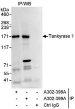 Tankyrase 1 Antibody in Immunoprecipitation (IP)