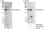 Tankyrase 1 Antibody in Western Blot (WB)