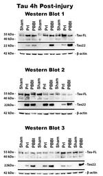 Tau (Cleaved Asp421, Asp422) Antibody in Western Blot (WB)