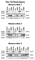 Tau (Cleaved Asp421, Asp422) Antibody in Western Blot (WB)