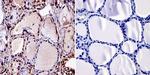 THRB Antibody in Immunohistochemistry (Paraffin) (IHC (P))