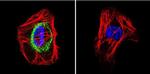 TSH Receptor Antibody in Immunocytochemistry (ICC/IF)