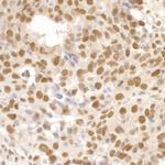 Timeless Antibody in Immunohistochemistry (IHC)