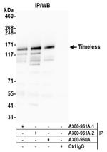 Timeless Antibody in Western Blot (WB)