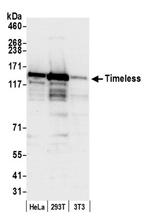 Timeless Antibody in Western Blot (WB)