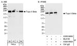 Topo II Beta Antibody in Western Blot (WB)